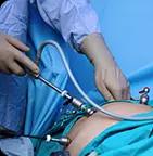 Laparoscopic Surgery