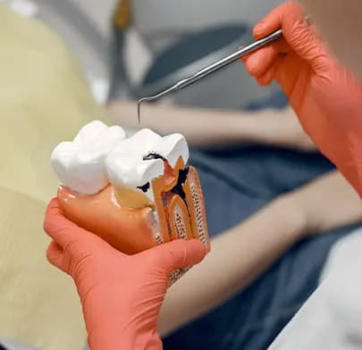 https://dxfqlcpql5f3t.cloudfront.net/Treatment/endodontics.webp