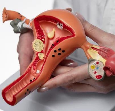 https://dxfqlcpql5f3t.cloudfront.net/Treatment/endometrial-ablation.webp