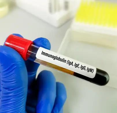 https://dxfqlcpql5f3t.cloudfront.net/Treatment/immunoglobulin-therapy.webp