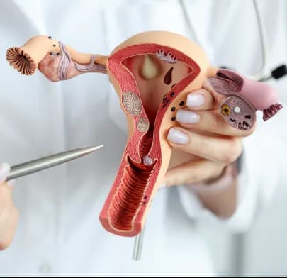 https://dxfqlcpql5f3t.cloudfront.net/Treatment/myomectomy.webp