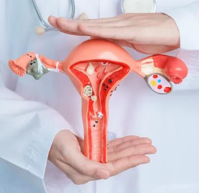 https://dxfqlcpql5f3t.cloudfront.net/Treatment/oophorectomy.webp
