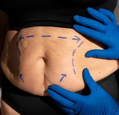 https://dxfqlcpql5f3t.cloudfront.net/Treatment/whipples-surgery.webp
