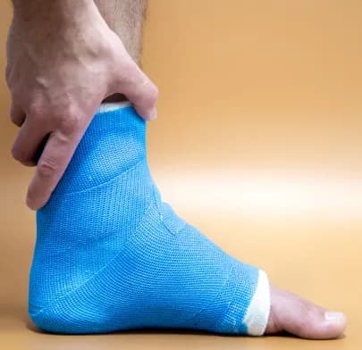 Internal and External Fracture Fixation