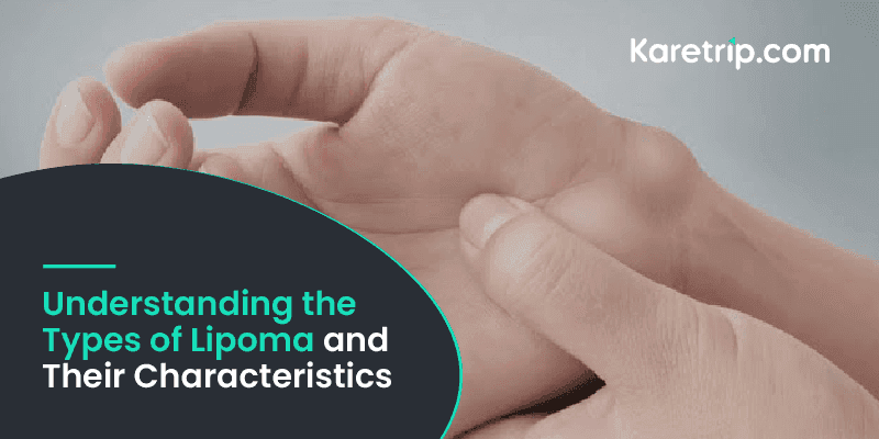 Understanding the Types of Lipoma and Their Characteristics