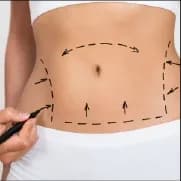 What Is Bariatric Surgery? Eligibility, Cost & Weight Loss Outcomes