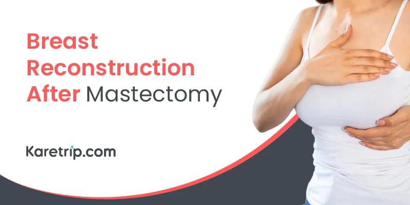 Breast reconstruction