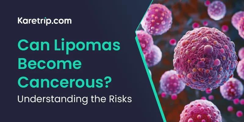 Can Lipomas Become Cancerous