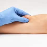 How Safe is Lipoma Surgery? Understanding Risks & Benefits