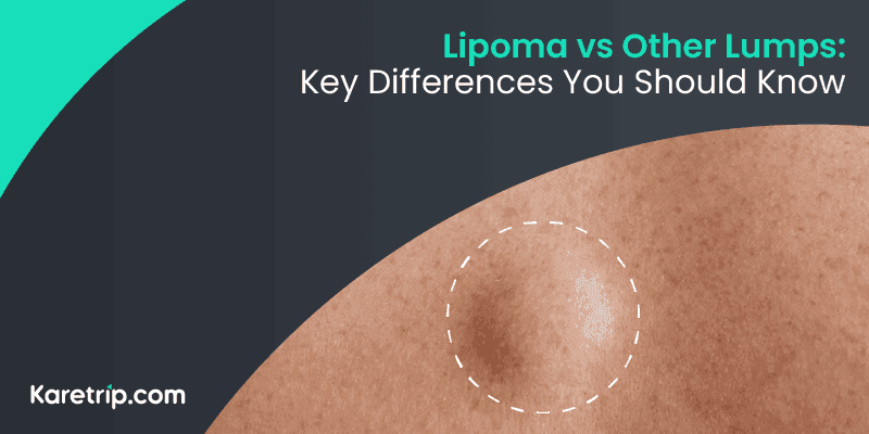 Lipoma vs Other Lumps: Key Differences You Should Know