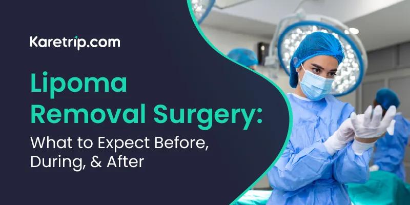 Lipoma Removal Surgery: What to Expect Before, During, and After