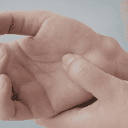 Understanding the Types of Lipoma and Their Characteristics