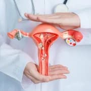 PCOS Awareness: Symptoms, Diagnosis, and Treatment Options