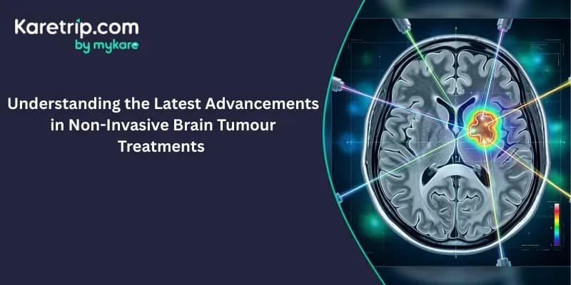 Understanding the LatNon-Invasive Brain Tumour Treatments in india karetrip