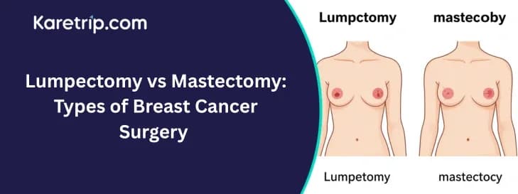 what is a mastectomy