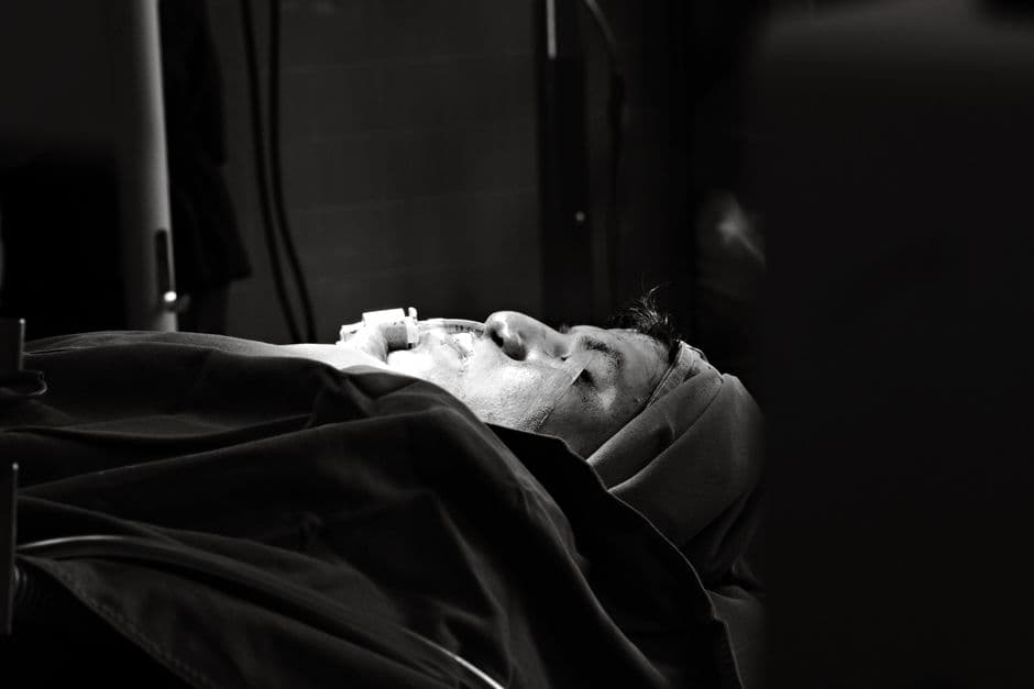 Cardiac Surgery Complications and Recovery What Patients Need to Know